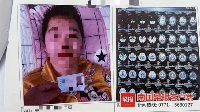女子做人流手术致二级伤残,家属索赔200多万元!判了! 女子做人流手术致二级伤残,家属索赔200多万元!判了!
